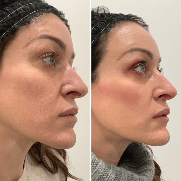 SkinFix: Sculpting Facial
