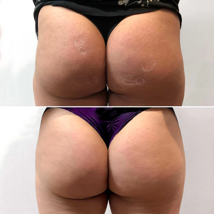 before after boots