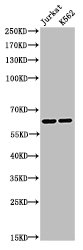 Acetyl-RELA (K218) Antibody (PACO06064)