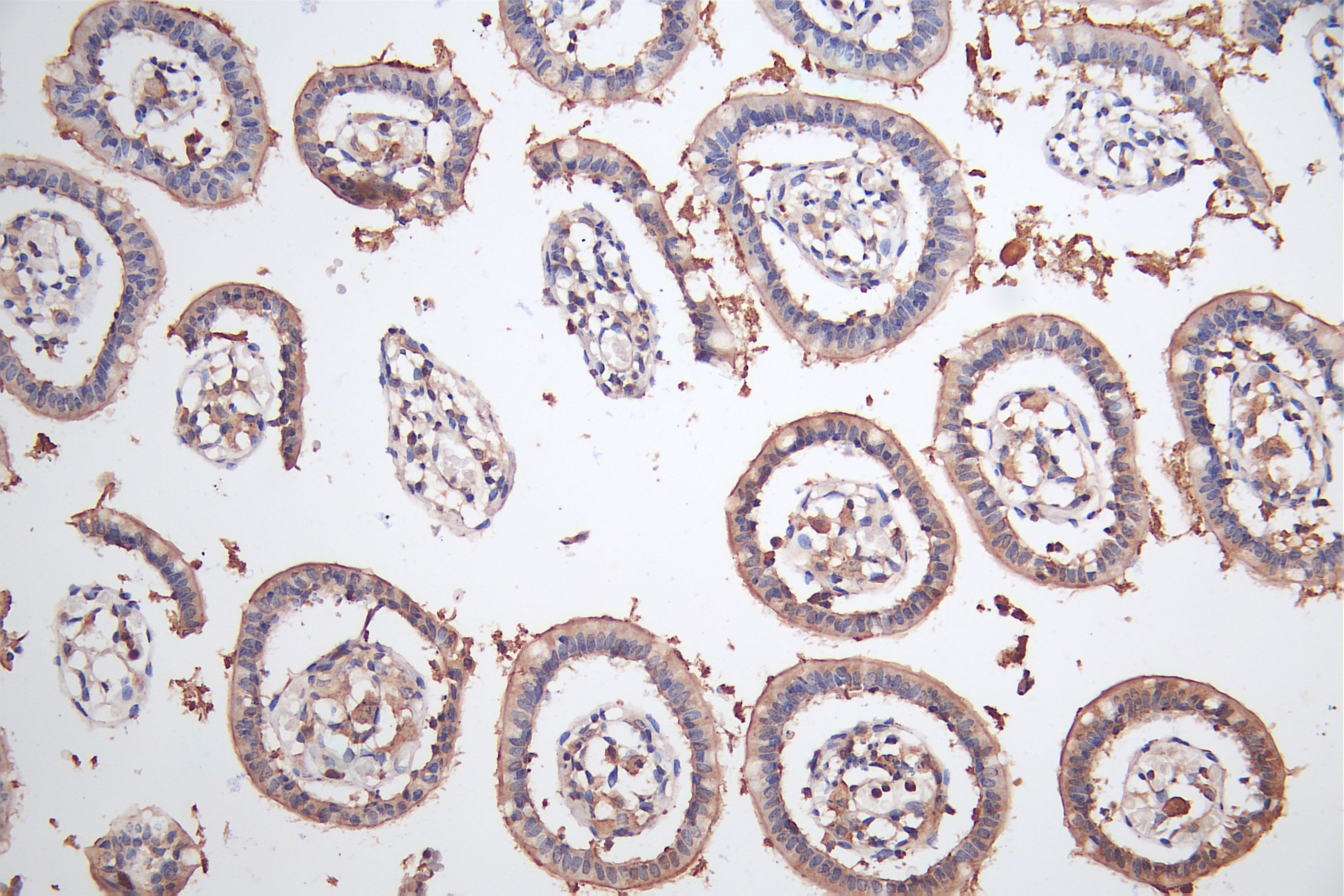 Immunohistochemistry(IHC) 1- BTNL2 Antibody