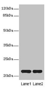 Rabbit anti-Homo sapiens (Human) CXXC4 Polyclonal antibody (PACO44756)