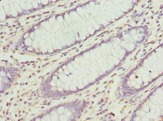 Rabbit anti-Homo sapiens (Human) CXXC4 Polyclonal antibody (PACO44756)