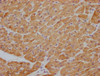 Anti-ACTB/POTEKP/ACTG1 Antibody MACO0470