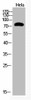 Acetyl-UBA52/RPS27A/UBB/UBC K48 Antibody PACO06081