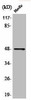 Phospho-JUN/JUND S73/100 Antibody PACO06094