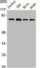 ACTN1/ACTN2/ACTN3/ACTN4 Antibody PACO06230