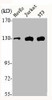 EPHA2/EPHA3/EPHA4 Antibody PACO06464