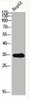 ACER1 Antibody PACO07204