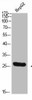 TPSD1 Antibody PACO07265