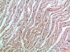 MIA Antibody PACO07406