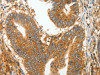 MMP28 Antibody PACO14715