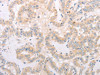 SPATA16 Antibody PACO15163