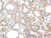 AADACL2 Antibody PACO15216