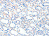 ACSM5 Antibody PACO15271