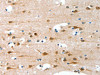 ALS2CR11 Antibody PACO15415