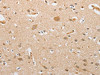 CSGALNACT2 Antibody PACO15718