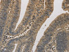 ELOVL1 Antibody PACO16254