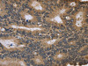 FGFR1OP2 Antibody PACO16342