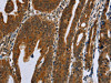 GH2 Antibody PACO16412