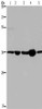 LZTFL1 Antibody PACO16640