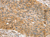 SNX11 Antibody PACO17136