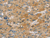 ST18 Antibody PACO17158