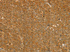 ST18 Antibody PACO17159