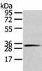 STX19 Antibody PACO17201