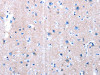 LAMA3 Antibody PACO18136