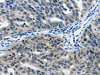 MATN1 Antibody PACO18189