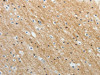 ADAMTS19 Antibody PACO18514