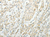 AGBL1 Antibody PACO18528