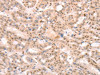 PTMA Antibody PACO18981