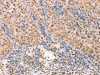 PTMA Antibody PACO18981