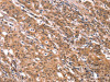 FGF22 Antibody PACO19658