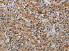 AATK Antibody PACO20089