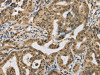 CENPV Antibody PACO20280