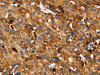 SLC27A5 Antibody PACO20499