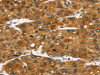 TACC2 Antibody PACO20649