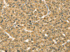 TMPRSS3 Antibody PACO20718