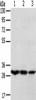 TPD52L2 Antibody PACO20739