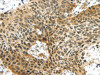 TTBK2 Antibody PACO20784