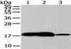 VAMP2 Antibody PACO20849