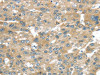 BRWD1 Antibody PACO20873