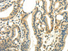 WNK2 Antibody PACO20886