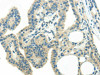 WNK3 Antibody PACO20909