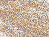 APLN Antibody PACO20970
