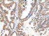 MUC1 Antibody PACO20979