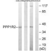 PPP1R2 Ab-44 Antibody PACO21630