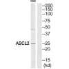 ASCL2 Antibody PACO21935